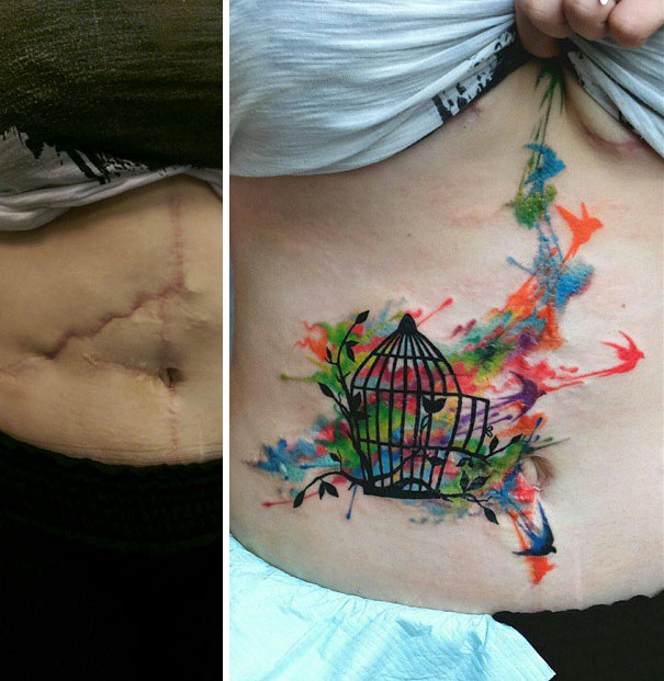 Tatuajes tapar cicatrices abdominoplastia 4