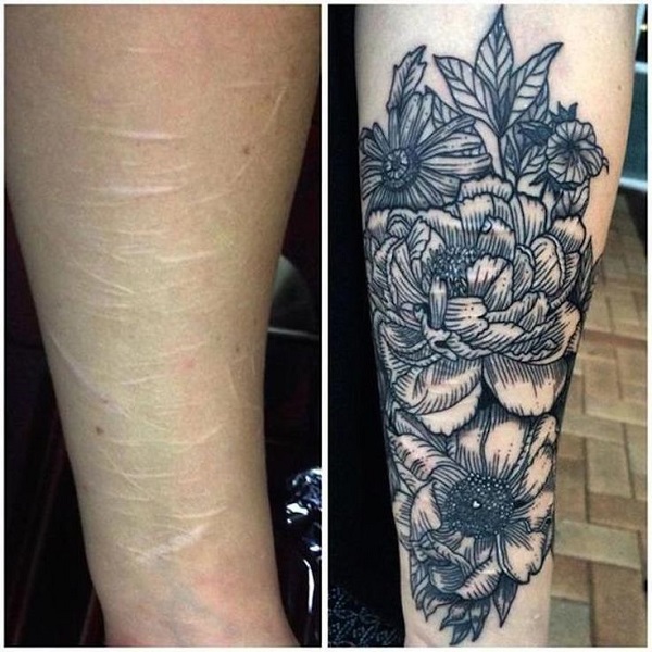 Tatuajes tapar cicatrices en el brazo 2