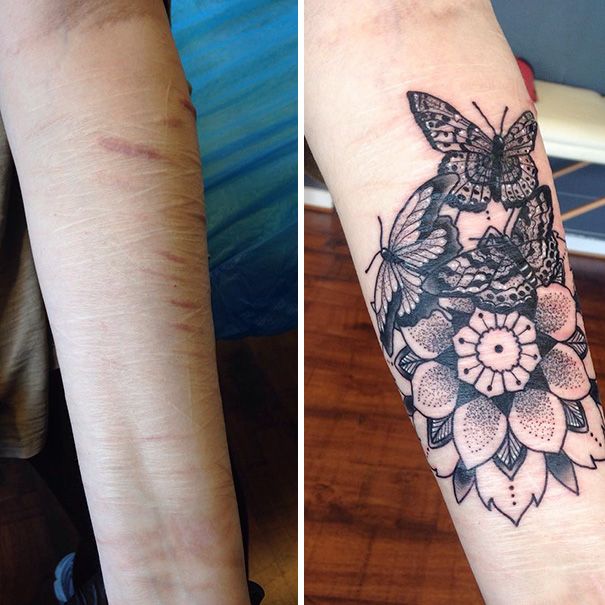 Tatuajes tapar cicatrices en el brazo