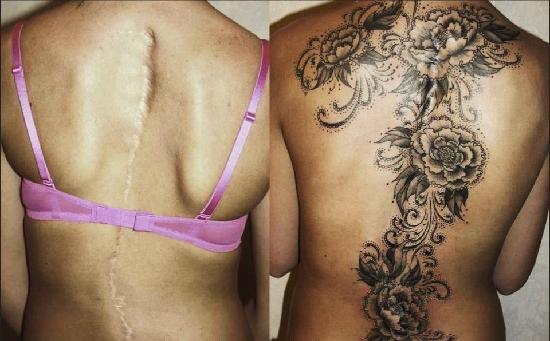 Tatuajes tapar cicatrices en la espalda 2