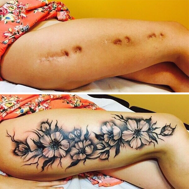Tatuajes tapar cicatrices en pierna